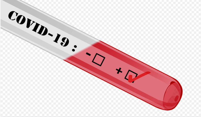 United Airlines et Lufthansa offriront des tests COVID-19 rapides aux passagers en octobre